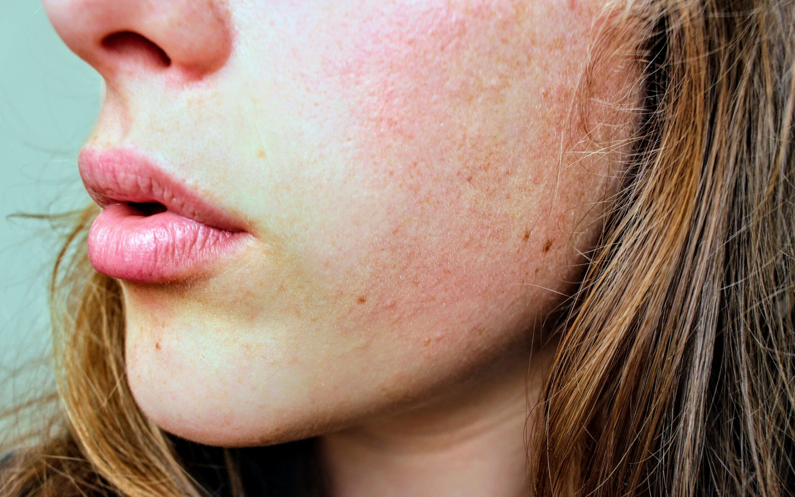 Is Your Skin Barrier Damaged? Here’s How to Tell and What to Do