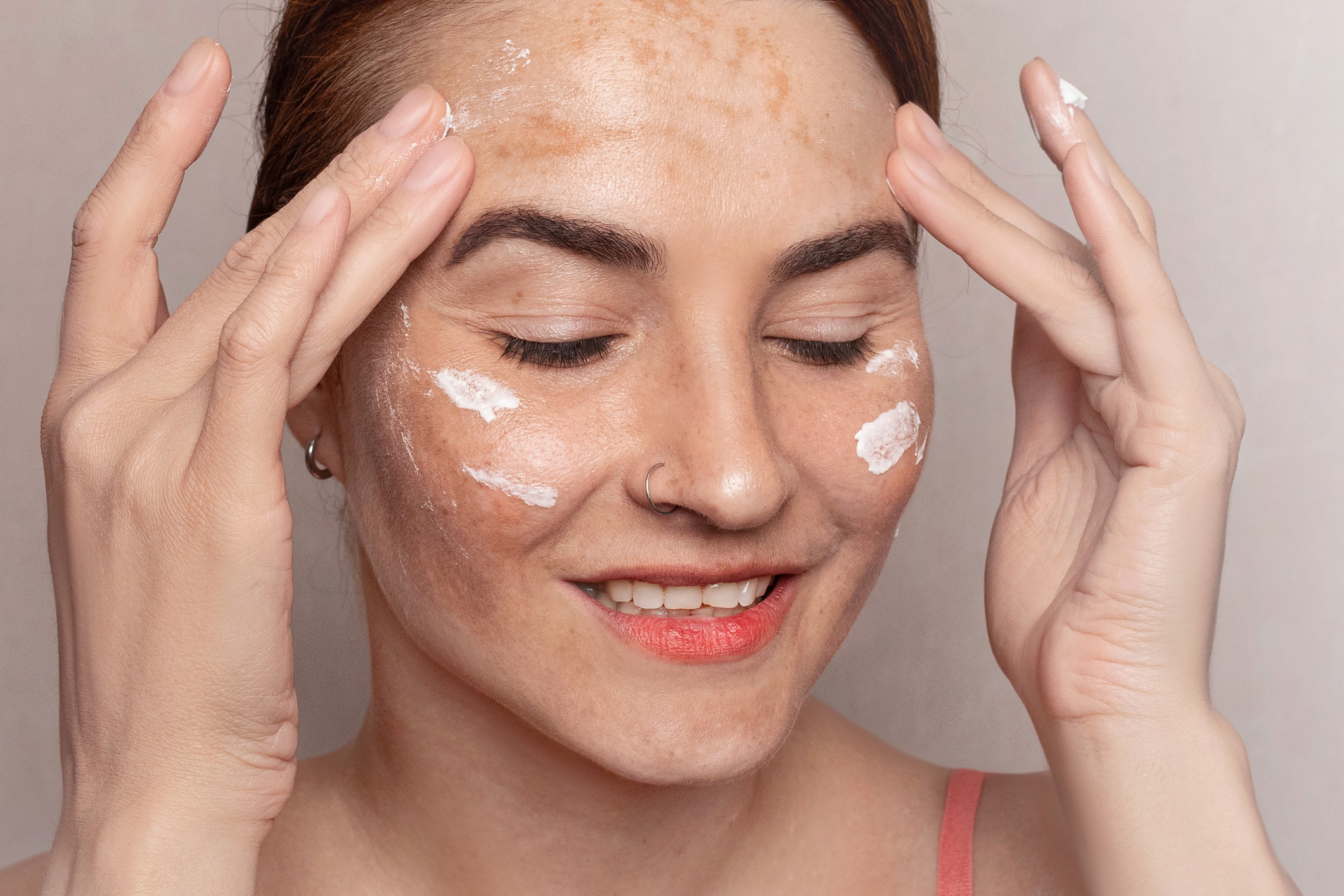 Melasma Treatment at Home: What Helps, What to Avoid